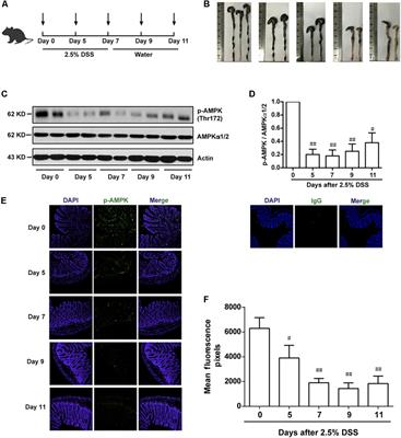 Activating AMPK to Restore Tight Junction Assembly in Intestinal Epithelium and to Attenuate Experimental Colitis by Metformin